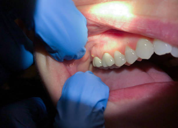 Best Emergency Root Canal Treatment in Hrison, AR